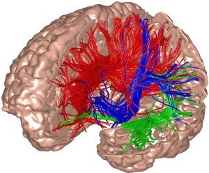 Sagittal cross section of brain